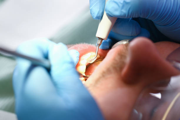 Best Cracked Tooth Emergency Dentist  in Ronan, MT