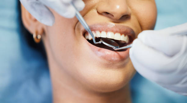 Best Dentist for Tooth Abscess  in Ronan, MT
