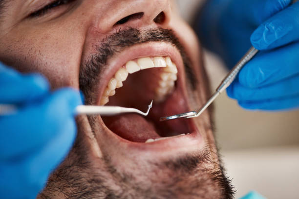 Best Urgent Tooth Repair  in Ronan, MT