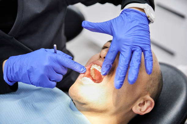 Best Knocked-Out Tooth Emergency  in Ronan, MT