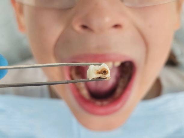 Best Broken Tooth Emergency  in Ronan, MT